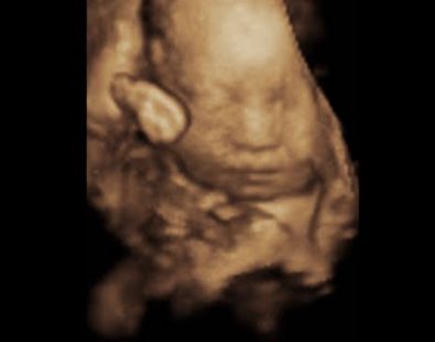 Baby Borucki Blog: 30 Week 3D Ultrasound
